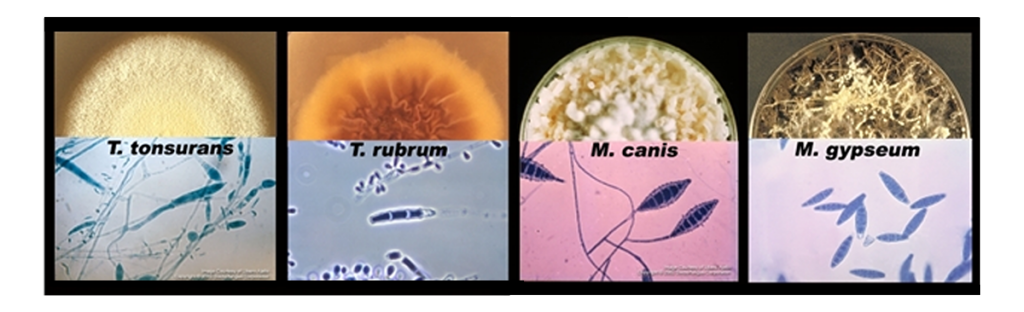 dermatophytes distriwel